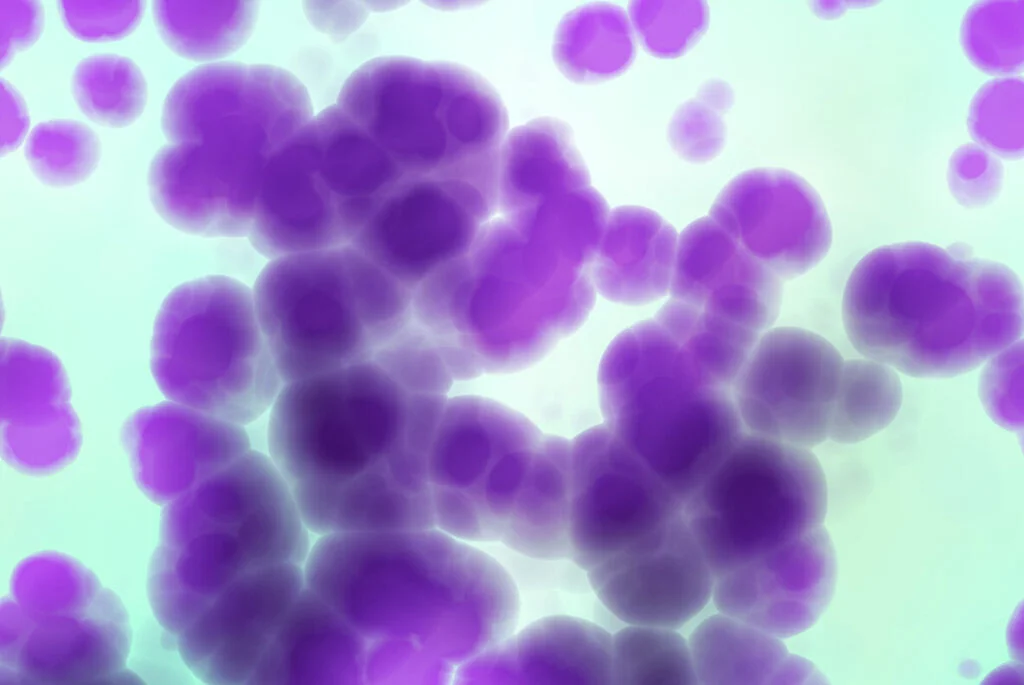 E5574_05.jpg E5574_05.jpg