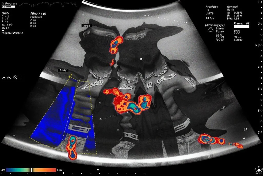 E9398_04.jpg E9398_04.jpg