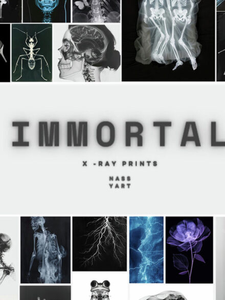 Unveiling the Aesthetic Power of Human Form: A Closer Look at the 55 Immortal X-ray Print Posters - Image 8